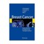 Breast Cancer: Nuclear Medicine in Diagnosis and Therapeutic Options Bombardieri