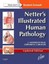 Netter's Illustrated Human Pathology by Gerhard R. F. Krueger, Maximilian L....