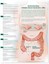 UNDERSTANDING IRRITABLE BOWEL SYNDROME POSTER (66x51cm) ANATOMICAL CHART NEW