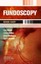 Fundoscopy Made Easy by Stephen J. Palmer, Mohan Varikkara, Sujoy Ghosh,...