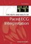 The Nuts and Bolts of Paced ECG Interpretation (Nuts and Bolts Series).