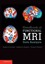 Handbook of Functional MRI Data Analysis by Russell Alan Poldrack, Jeanette...
