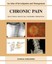 Chronic Pain: An Atlas of Investigation and Management by Dawn A. Marcus.