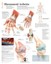 Rheumatoid Arthritis Educational Chart Poster 56 X 71cm Classroom Wall Chart New