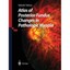 Atlas of Posterior Fundus Changes in Pathologic Myopia Takashi Tokoro