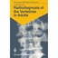 Radiodiagnosis of the Vertebrae in Adults: 125 Exercises for Students and Practi