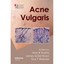 Acne Vulgaris Shalita, Alan R., M.D. (Editor)/ Del Rosso, James Q. (Editor)/ Web