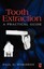 Tooth Extraction: A Practical Guide by Paul D. Robinson.