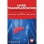 Liver Transplantation: Clinical Assessment and Management